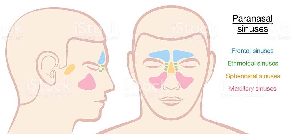 Paranasal sinus disease new arrivals