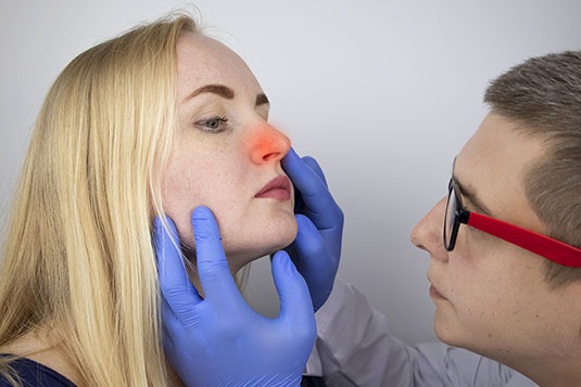 nasal polyps treatment